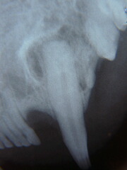 dental xray 